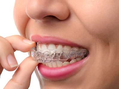 A person holding a clear retainer with their fingers, showcasing its transparency.