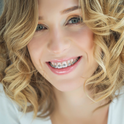 A young woman with braces smiles at the camera.