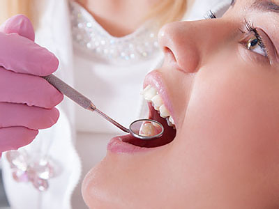 Woman receiving dental treatment with a dental hygienist using a dental pick on her teeth.